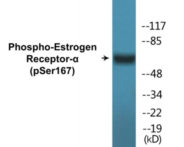 Estrogen Receptor-alpha Phospho-Ser167 Colorimetric Cell-Based ELISA Kit