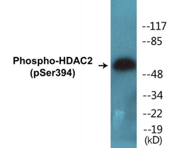 HDAC2 Phospho-Ser394 Colorimetric Cell-Based ELISA Kit