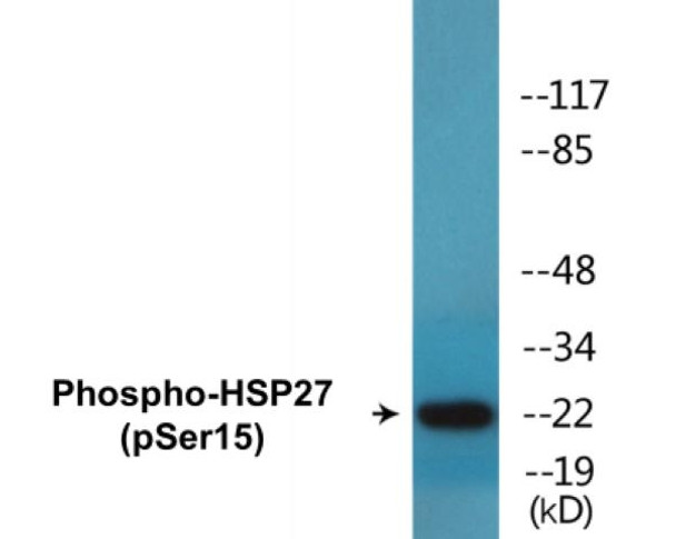 HSP27 Phospho-Ser15 Colorimetric Cell-Based ELISA Kit