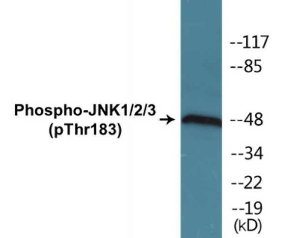 JNK1/2/3 Phospho-Thr183 Colorimetric Cell-Based ELISA Kit