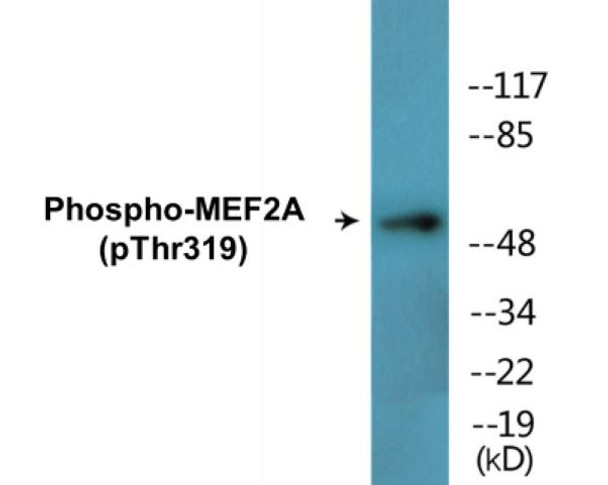 MEF2A Phospho-Thr319 Colorimetric Cell-Based ELISA Kit