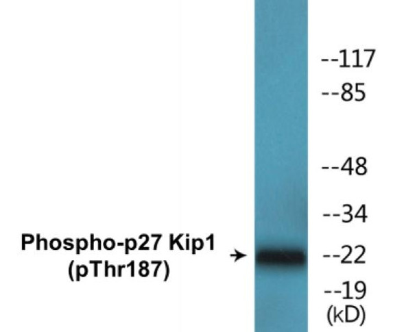 p27 Kip1 Phospho-Thr187 Colorimetric Cell-Based ELISA Kit