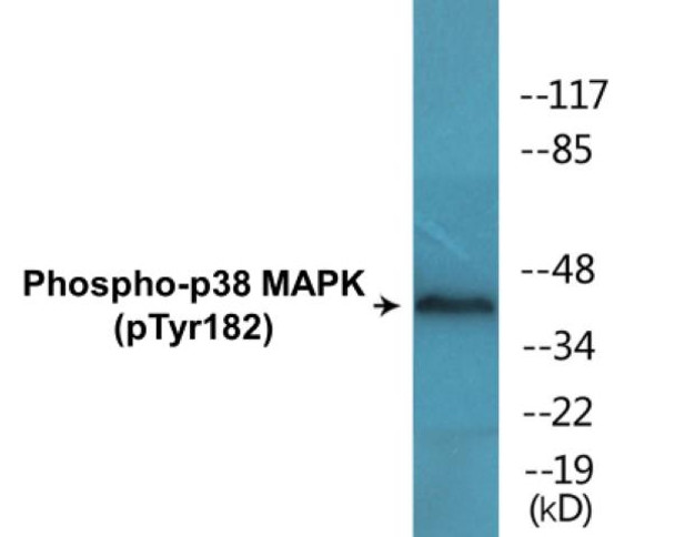 p38 MAPK Phospho-Tyr182 Colorimetric Cell-Based ELISA Kit