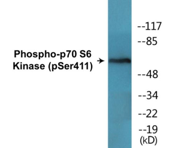 p70 S6 Kinase Phospho-Ser411 Colorimetric Cell-Based ELISA Kit