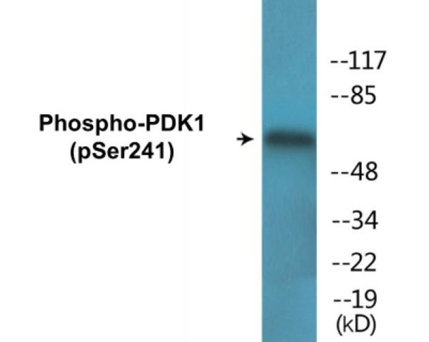 PDK1 Phospho-Ser241 Colorimetric Cell-Based ELISA Kit