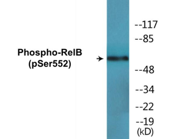 RelB Phospho-Ser573 Colorimetric Cell-Based ELISA Kit