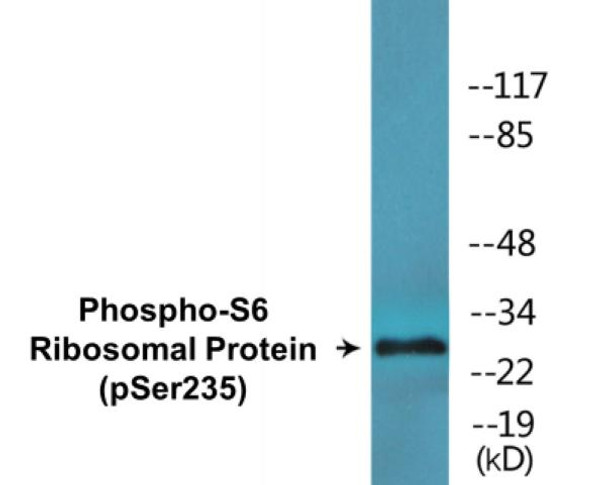 S6 Ribosomal Protein Phospho-Ser235 Colorimetric Cell-Based ELISA Kit