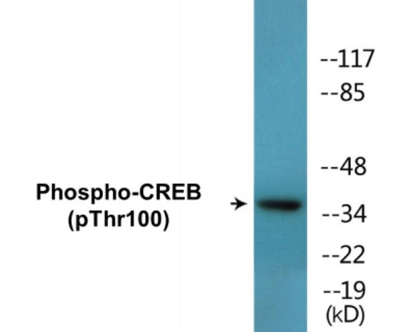 CREB Phospho-Thr100 Colorimetric Cell-Based ELISA Kit