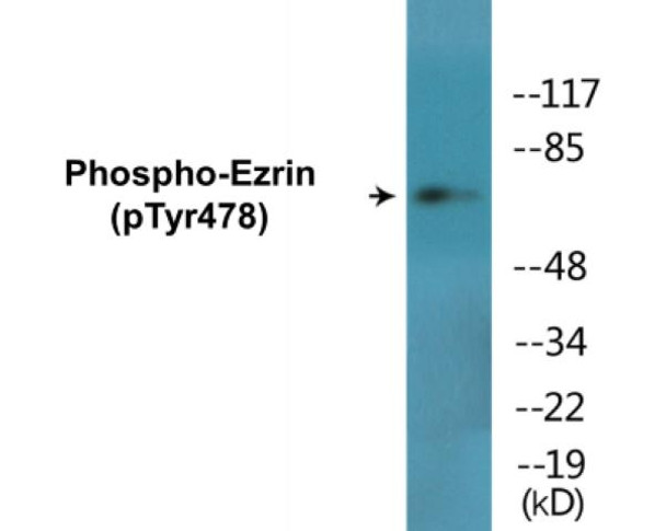 Ezrin Phospho-Tyr478 Colorimetric Cell-Based ELISA Kit