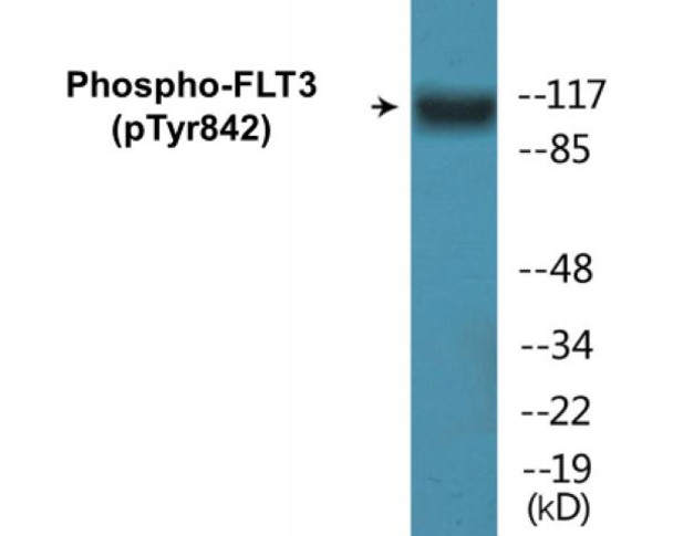 FLT3 Phospho-Tyr842 Colorimetric Cell-Based ELISA Kit