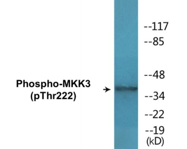 MKK3 Phospho-Thr222 Colorimetric Cell-Based ELISA Kit