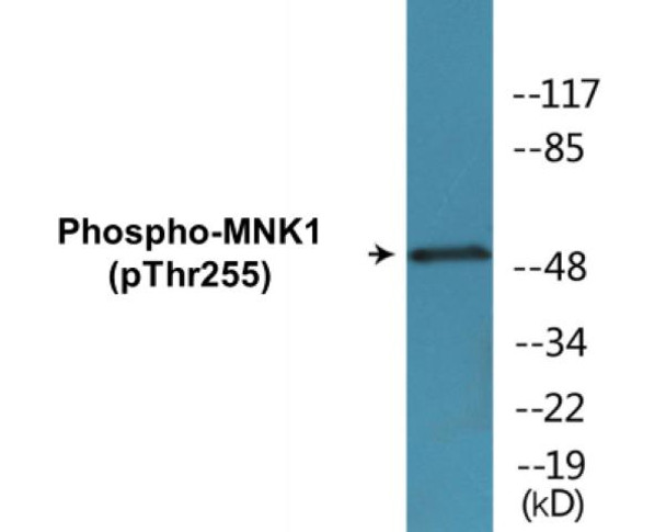 MNK1 Phospho-Thr255 Colorimetric Cell-Based ELISA Kit
