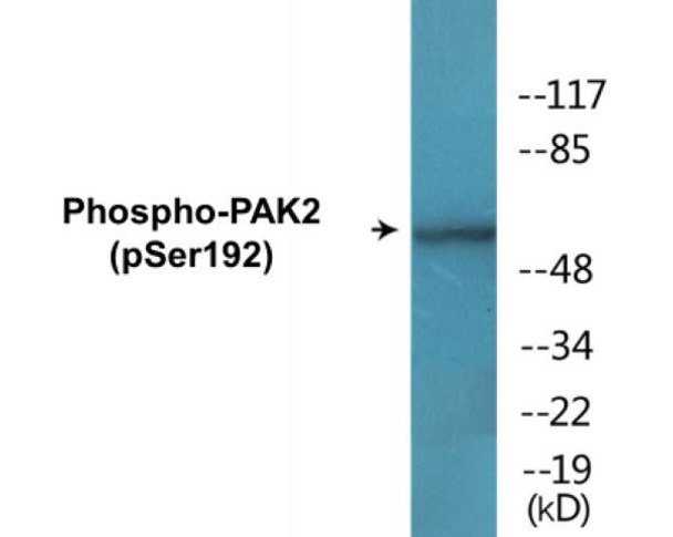 PAK2 Phospho-Ser192 Colorimetric Cell-Based ELISA Kit