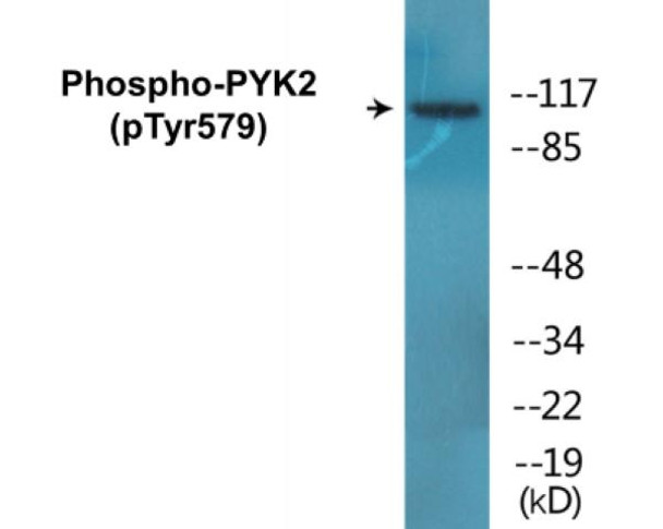 PYK2 Phospho-Tyr579 Colorimetric Cell-Based ELISA Kit