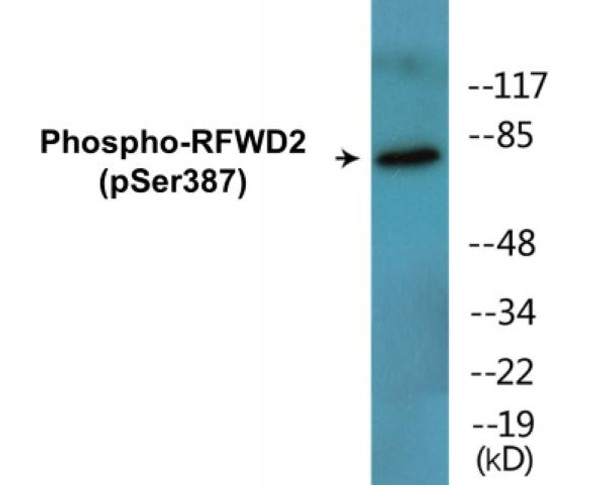 RFWD2 Phospho-Ser387 Colorimetric Cell-Based ELISA Kit