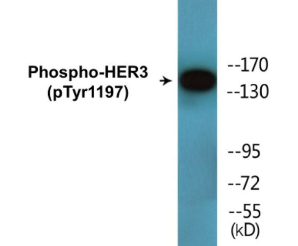 HER3 Phospho-Tyr1197 Colorimetric Cell-Based ELISA Kit