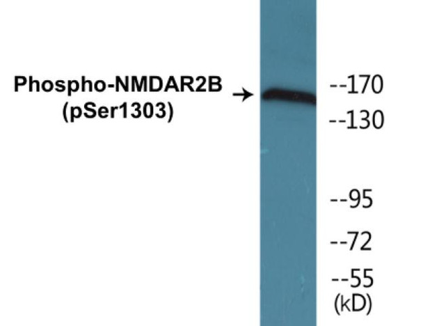 NMDAR2B Phospho-Ser1303 Colorimetric Cell-Based ELISA Kit