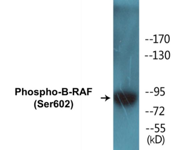 B-RAF Phospho-Ser602 Fluorometric Cell-Based ELISA Kit