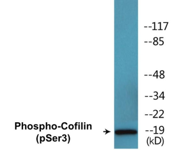 Cofilin Phospho-Ser3 Fluorometric Cell-Based ELISA Kit