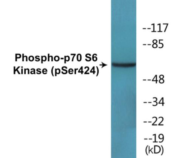 p70 S6 Kinase Phospho-Ser424 Fluorometric Cell-Based ELISA Kit