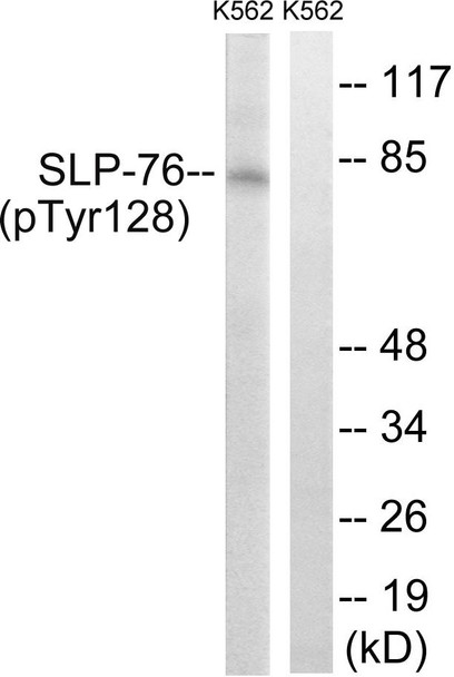 SLP-76 Phospho-Tyr128 Fluorometric Cell-Based ELISA Kit