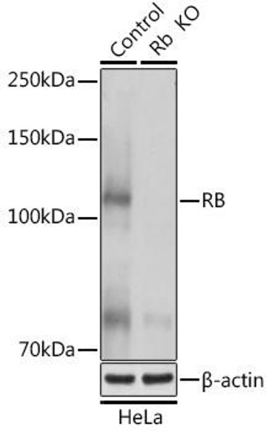 KO Validated Antibodies 1 Anti-RB Antibody CAB0003KO Validated
