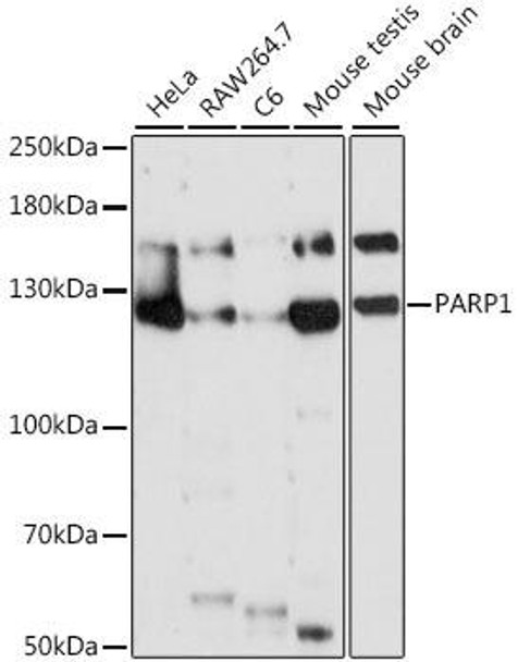 Epigenetics and Nuclear Signaling Antibodies 1 Anti-PARP1 Antibody CAB0010