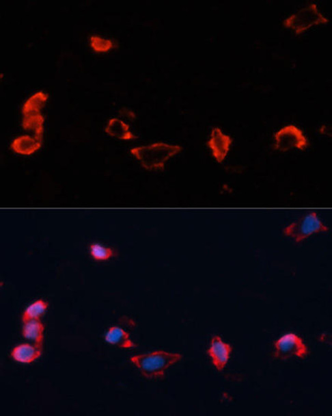 Immunology Antibodies 1 Anti-Caveolin-1 Antibody CAB0059