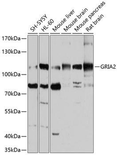 Signal Transduction Antibodies 2 Anti-GRIA2 Antibody CAB0111