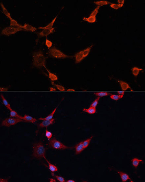 Cell Death Antibodies 1 Anti-INPP5D Antibody CAB0122