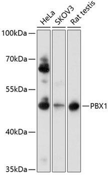 Developmental Biology Anti-PBX1 Antibody CAB0124