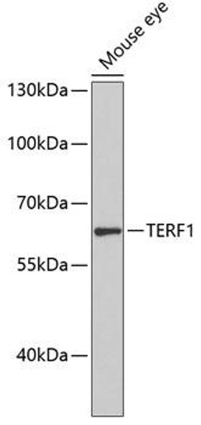 Cell Cycle Antibodies 1 Anti-TERF1 Antibody CAB0137