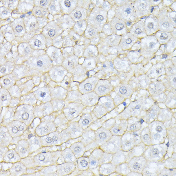 Cell Biology Antibodies 1 Anti-SPTAN1 Antibody CAB0160