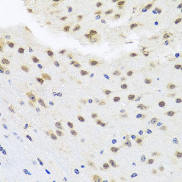 Epigenetics and Nuclear Signaling Antibodies 1 Anti-HDAC4 Antibody CAB0179