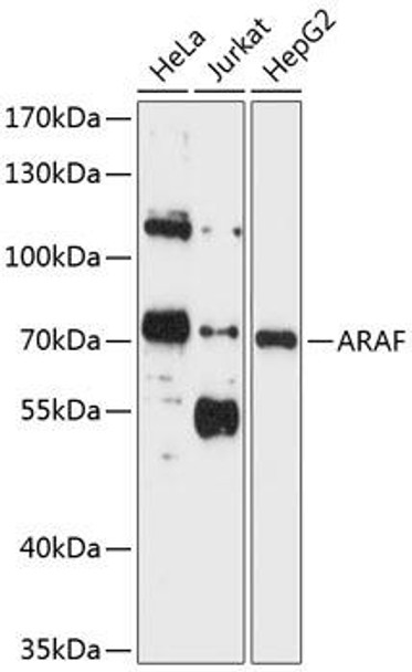 Cell Biology Antibodies 1 Anti-ARAF Antibody CAB0180