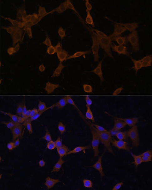 Cell Death Antibodies 1 Anti-Bid Antibody CAB0210