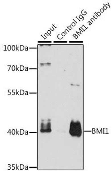 Epigenetics and Nuclear Signaling Antibodies 1 Anti-BMI1 Antibody CAB0211
