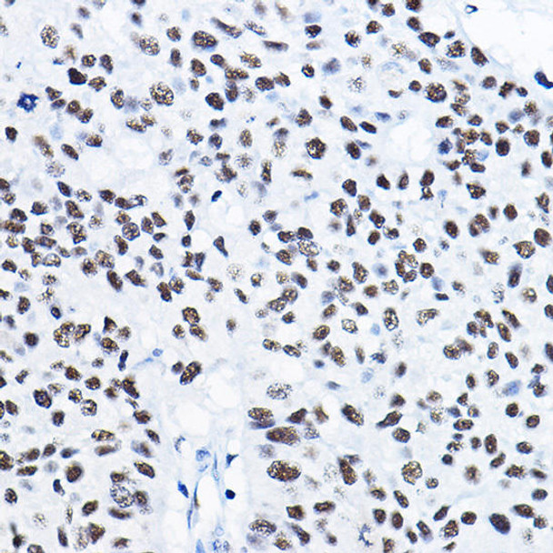 KO Validated Antibodies 1 Anti-HDAC1 Antibody CAB0238KO Validated