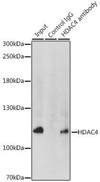 Epigenetics and Nuclear Signaling Antibodies 1 Anti-HDAC4 Antibody CAB0239