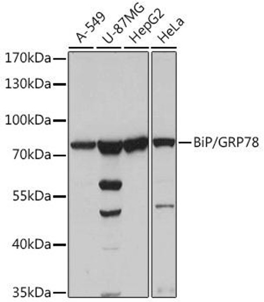 Cell Biology Antibodies 1 Anti-BiP/GRP78 Antibody CAB0241