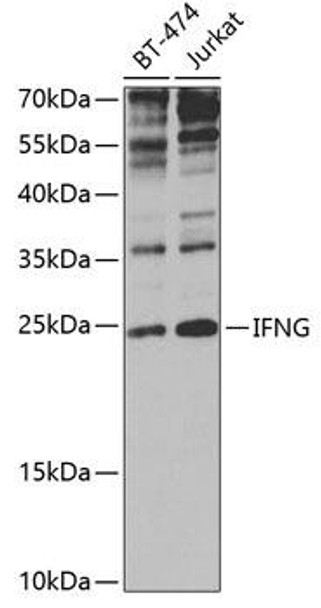 Immunology Antibodies 1 Anti-IFNG Antibody CAB0242