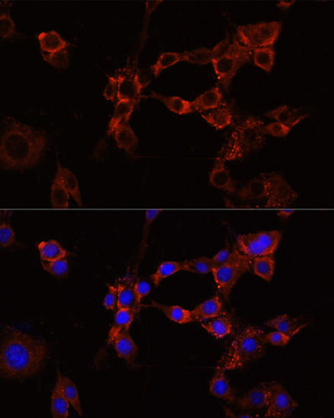 Cell Biology Antibodies 1 Anti-IGF1R Antibody CAB0243