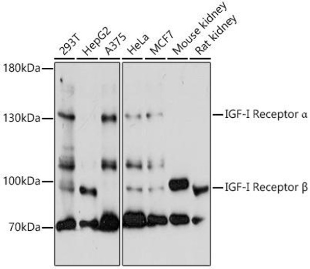 Cell Biology Antibodies 1 Anti-IGF1R Antibody CAB0243