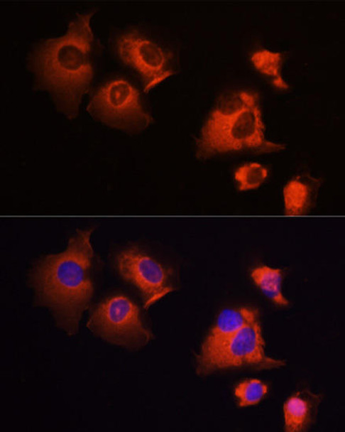 Cell Death Antibodies 1 Anti-MCL1 Antibody CAB0250