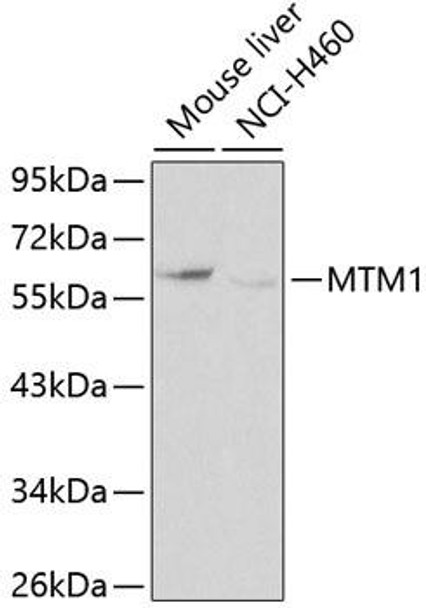 Metabolism Antibodies 1 Anti-MTM1 Antibody CAB0255