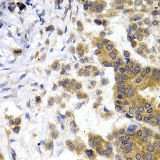 Cell Biology Antibodies 1 Anti-NEFL Antibody CAB0257