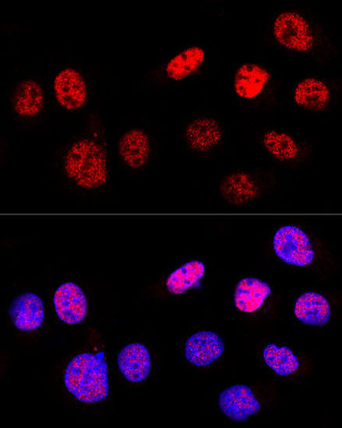 Cell Death Antibodies 1 Anti-p53 Antibody CAB0263