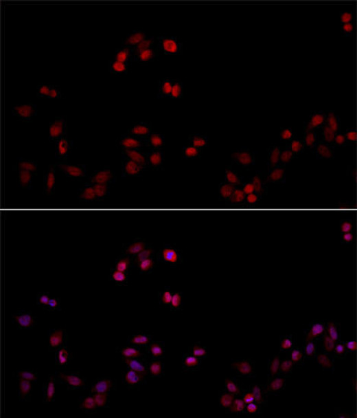 Epigenetics and Nuclear Signaling Antibodies 1 Anti-PCNA Antibody CAB0264