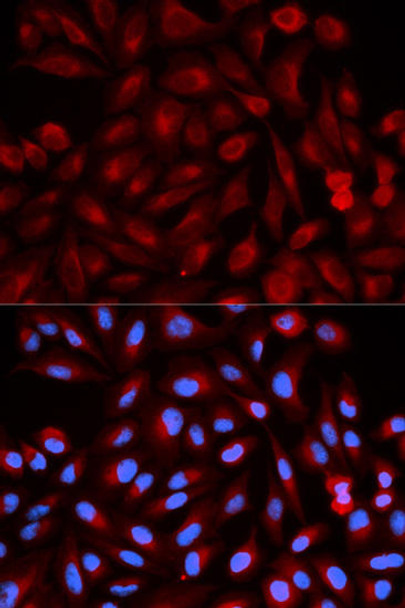 Cell Death Antibodies 1 Anti-PSME3 Antibody CAB0271