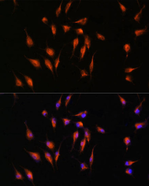 Cell Biology Antibodies 1 Anti-MMP9 Antibody CAB0289